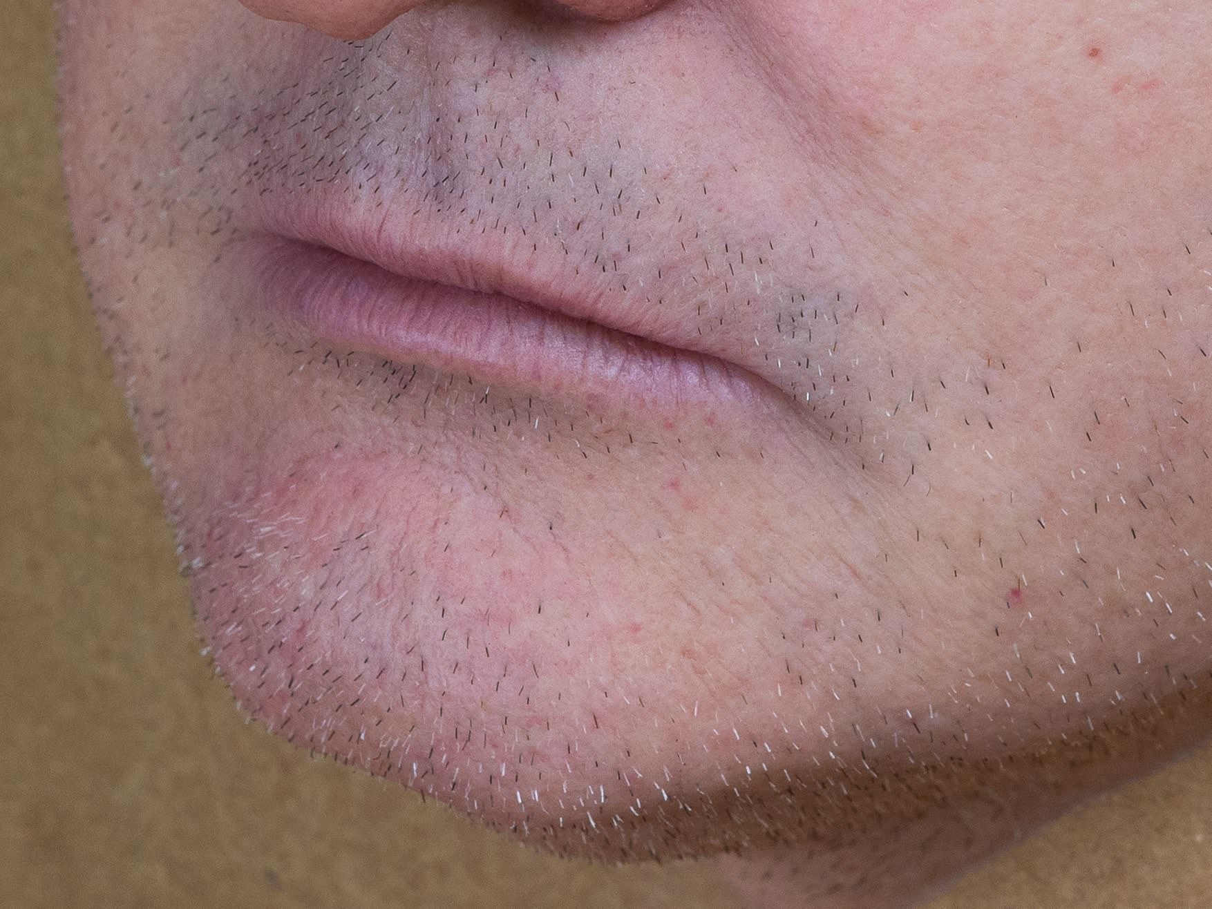 Close-up of hand-punched stubble around the mouth and chin of a silicone face by David Malinowski