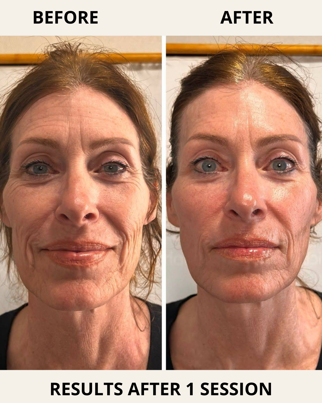 Treatment demonstration