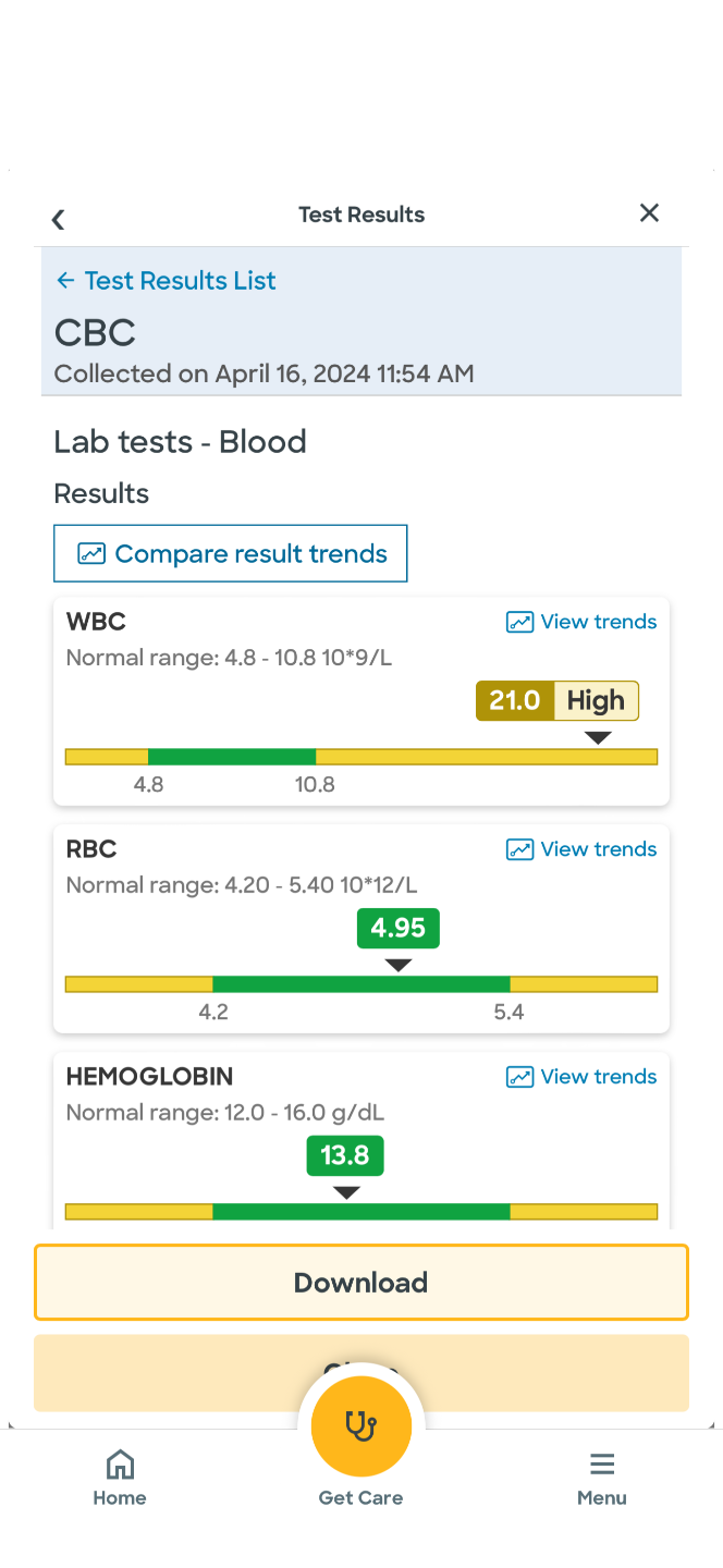 Lab result April 16 2024 showing WBC of 21.0 flagged High