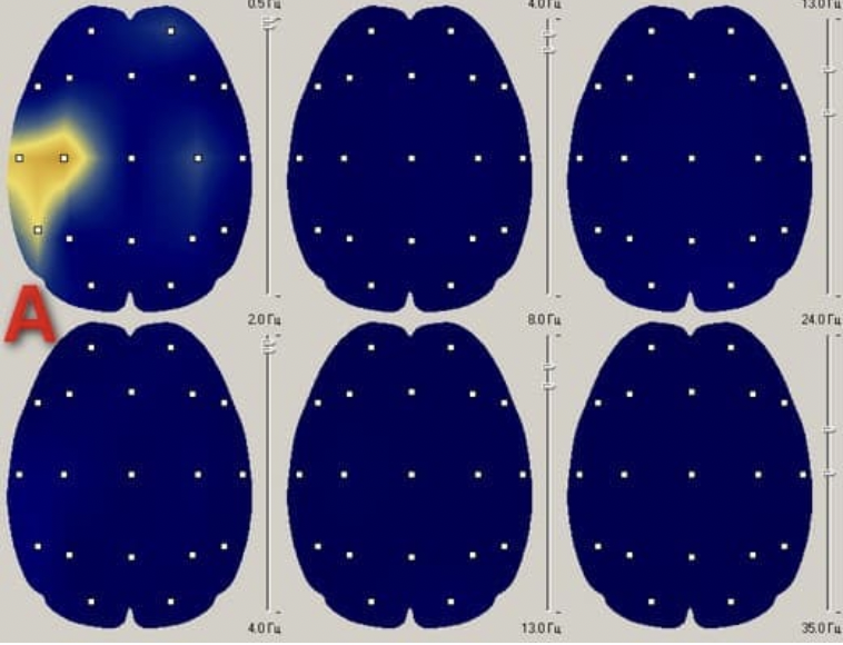 brain images before cell phone use