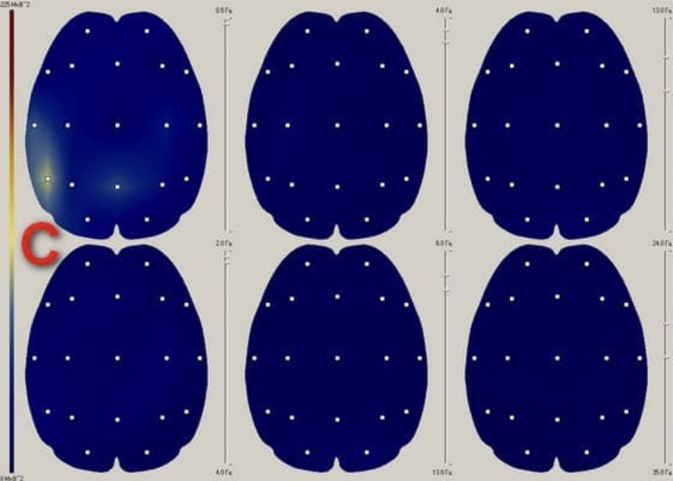 brain images using a protective device