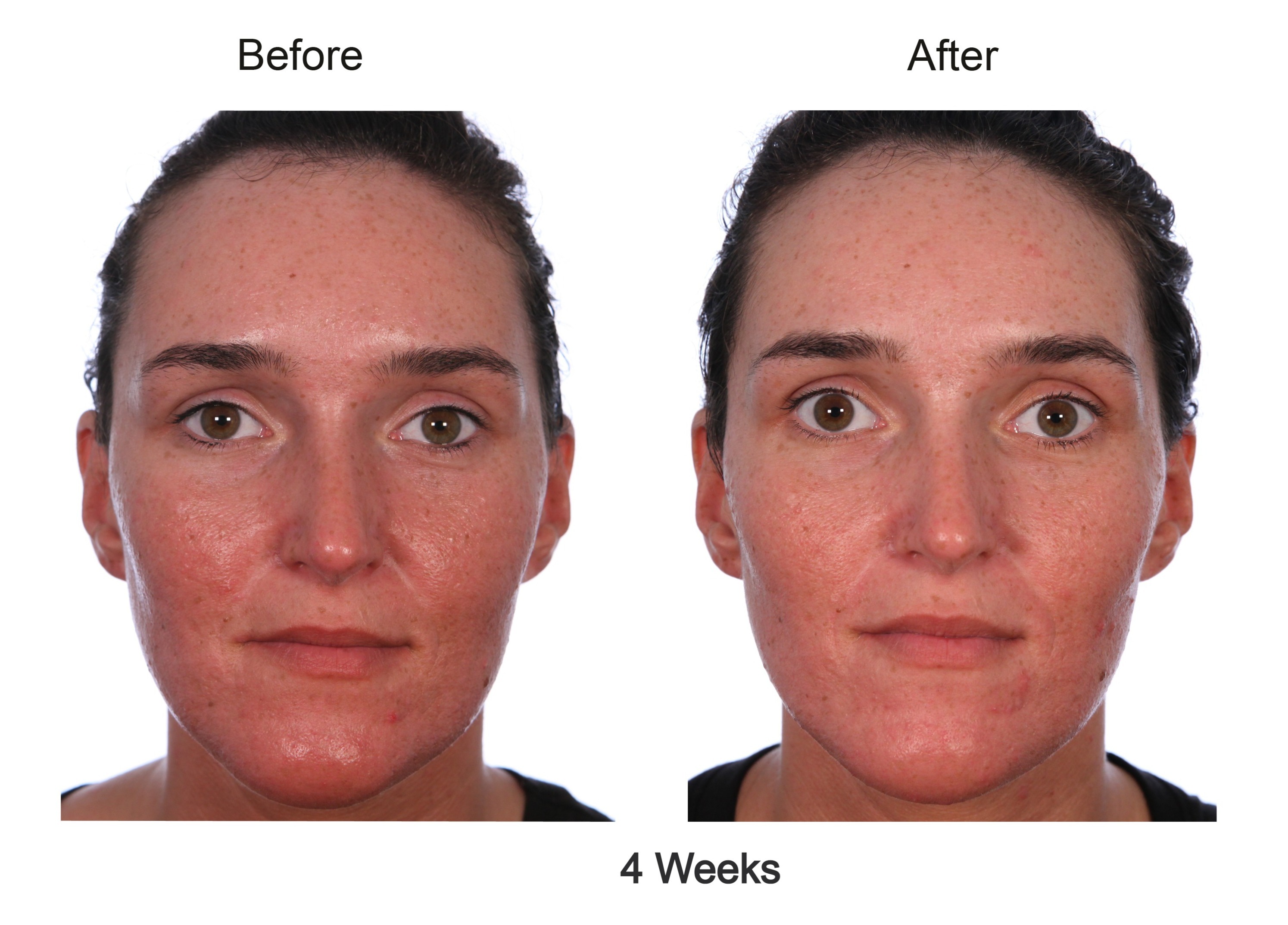 Collagen Drink Before After Do Collagen Drinks Work 