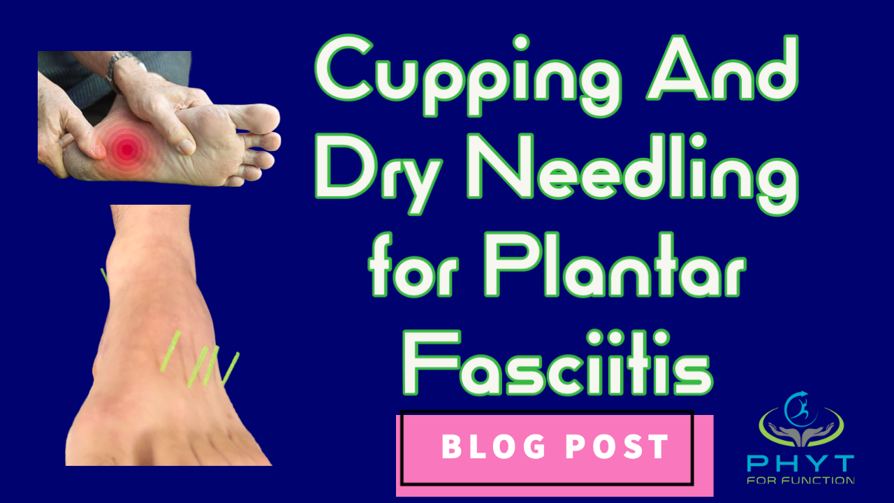 blog post image for cupping and dry needling for plantar fasciitis. 