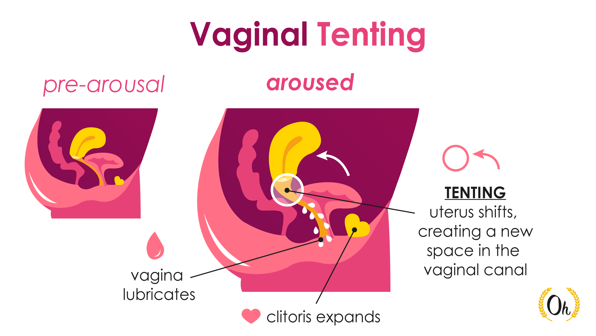 Back Spasms Uterine Contractions At Edward Silva Blog