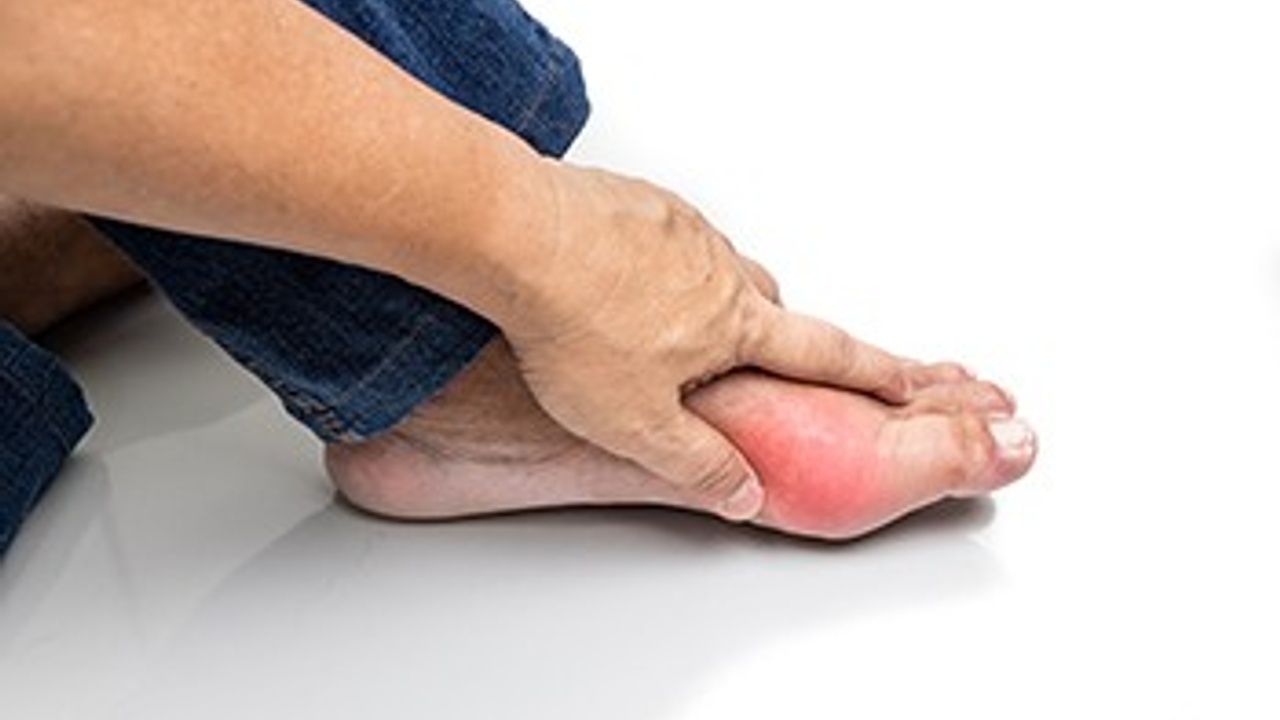 Dr. Frank Henry- Gout
