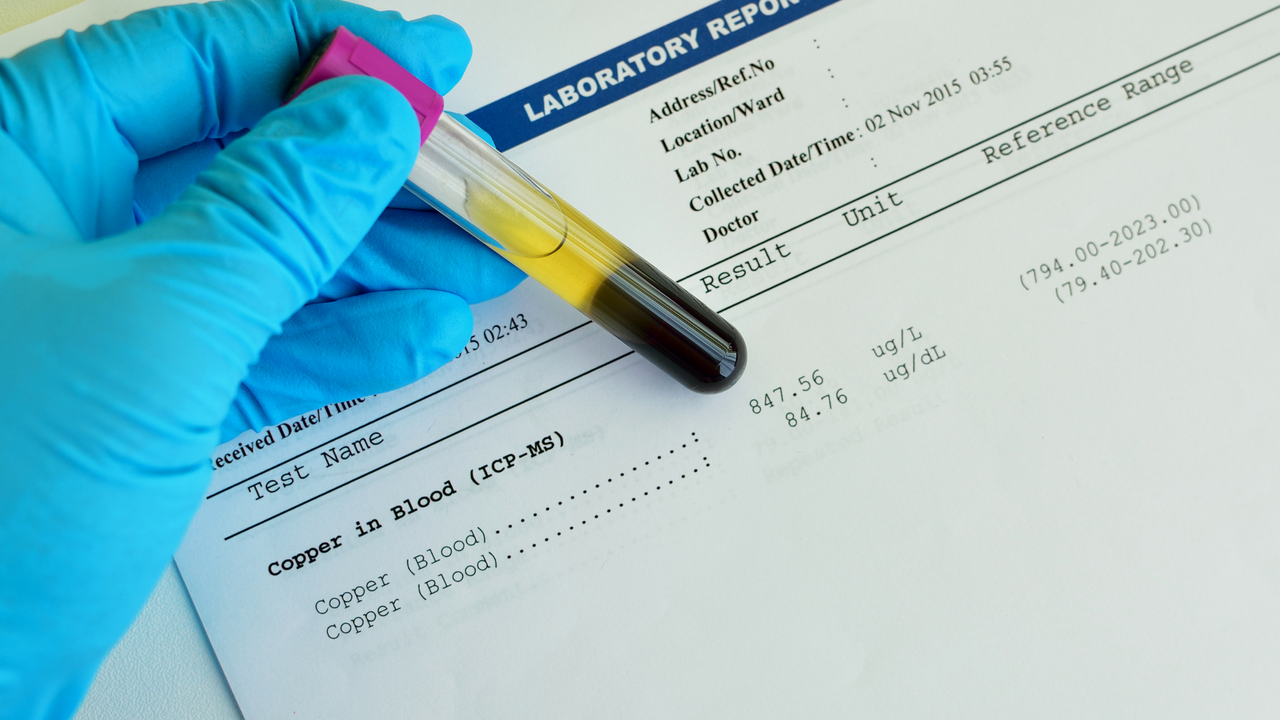 Copper Toxicity Misconceptions & Solutions