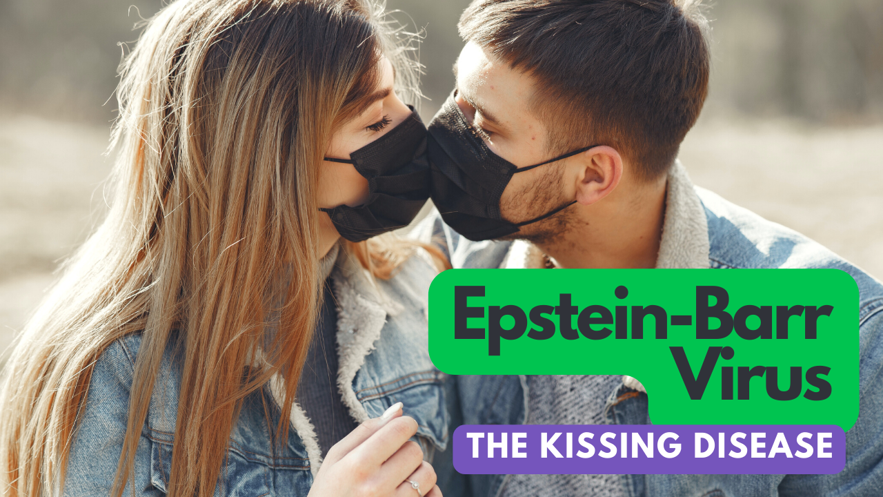 Kissing Disease - Epstein Barr Virus or Something Else?