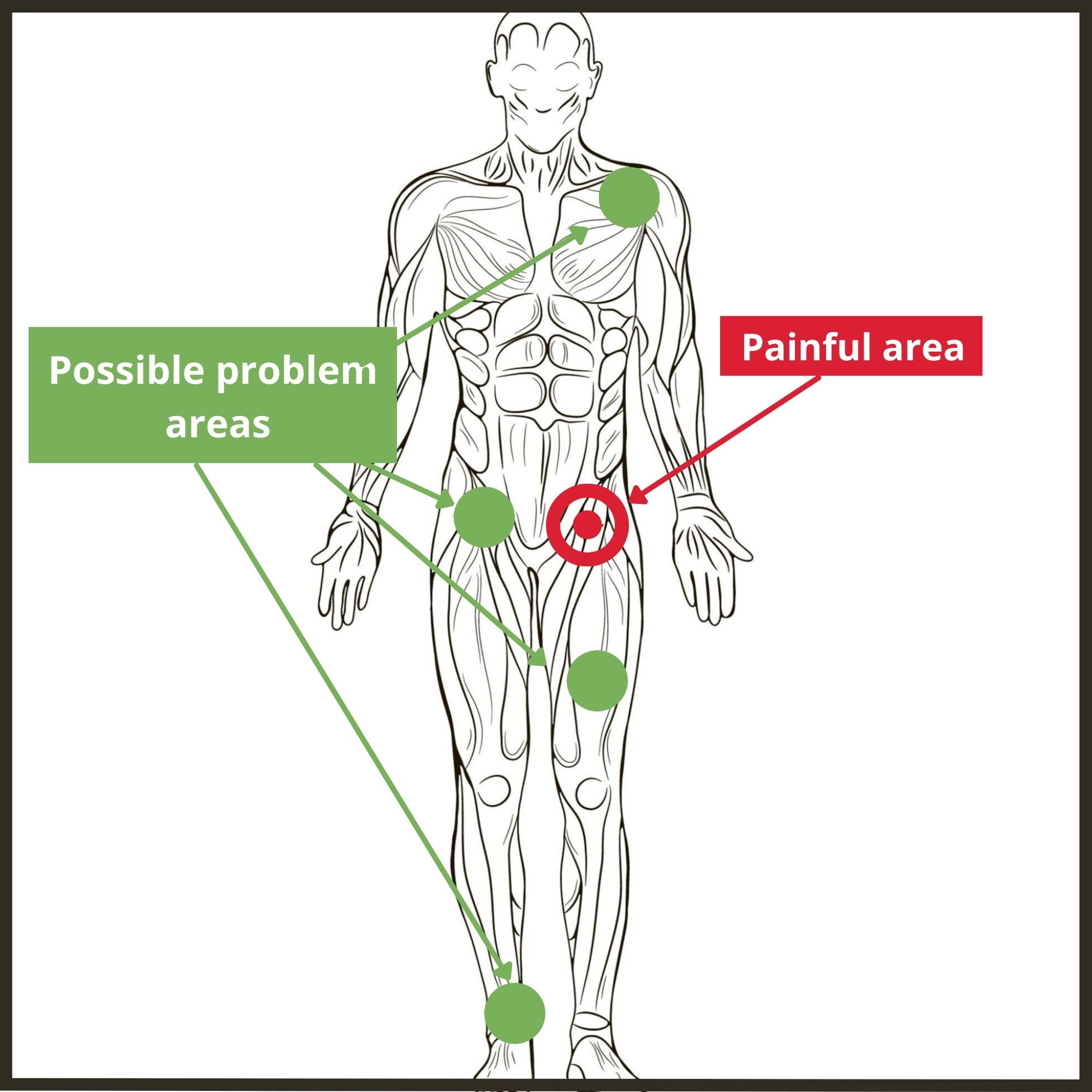 Hip Pain Location Diagram