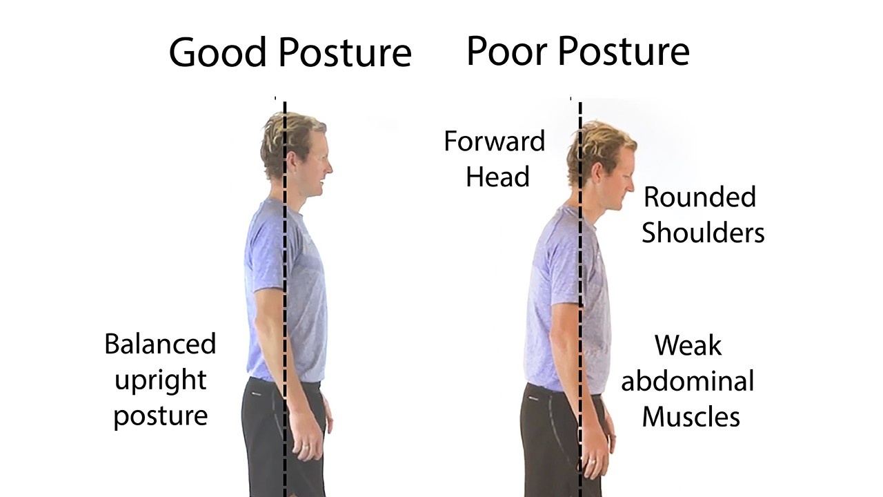 Poor Posture is a leading cause of injury