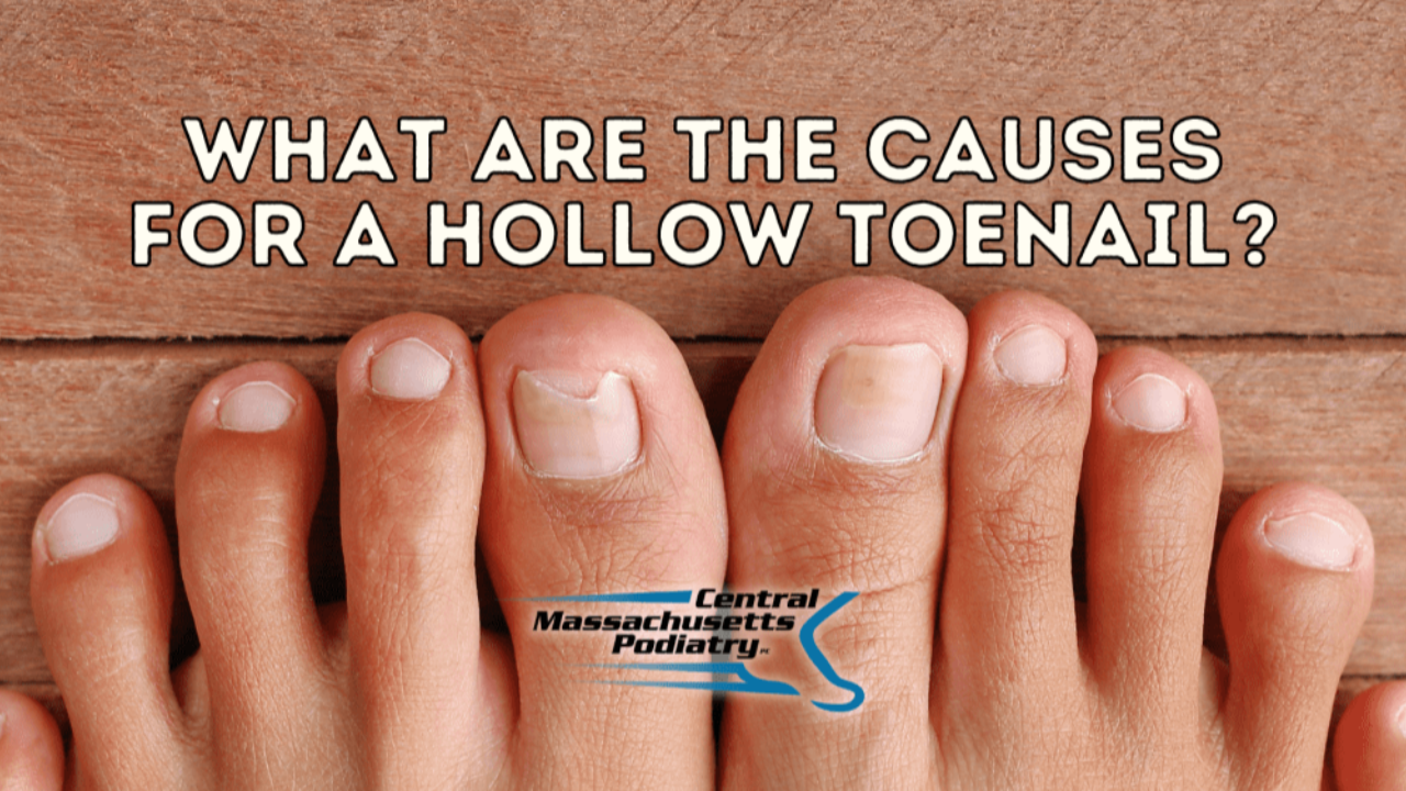 Detached Toenail or Onycholysis Treatment Process