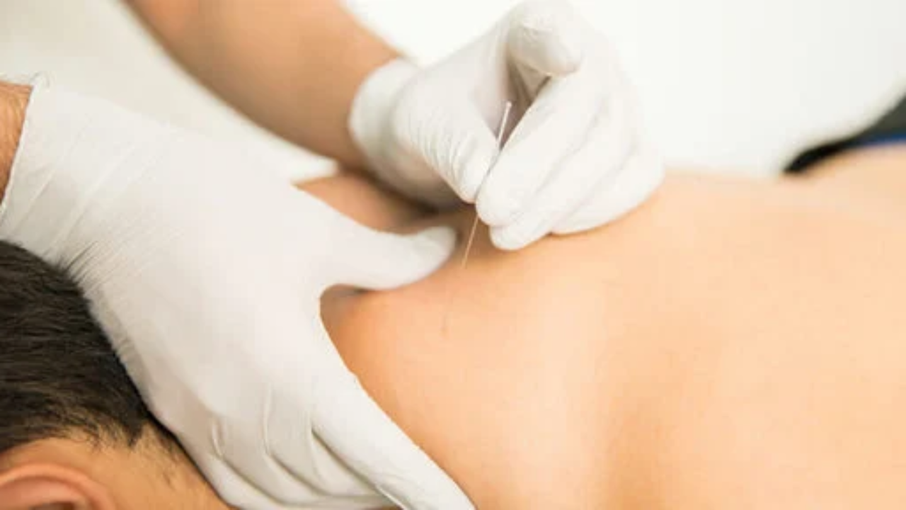 How Orthopedic Acupuncture Eases Chronic Back Pain in Busy Oakland Professionals