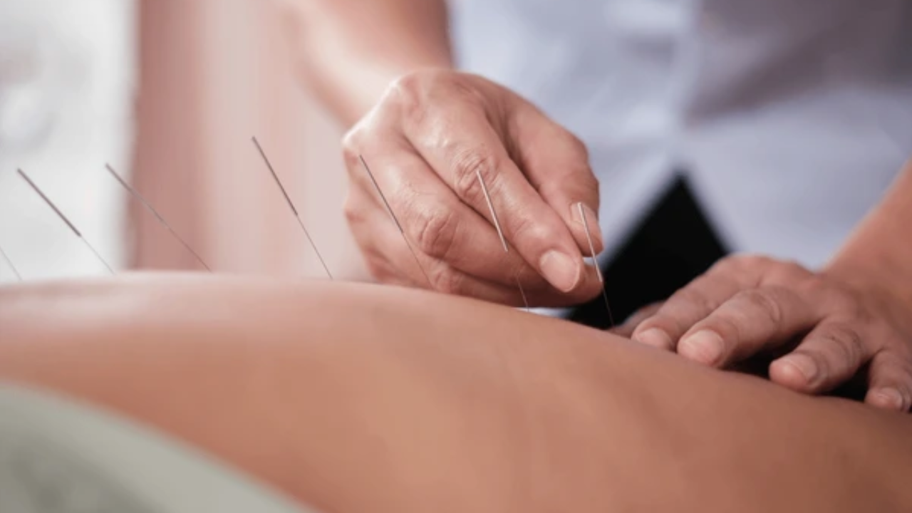 Chinese Medicine and Acupuncture for Anxiety: A Natural Way to Calm the Nervous System