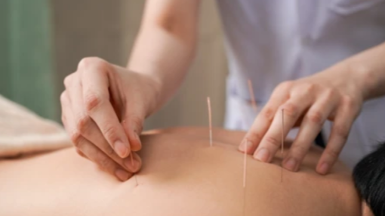 Daily Habits to Amplify Your Acupuncture Results at Home