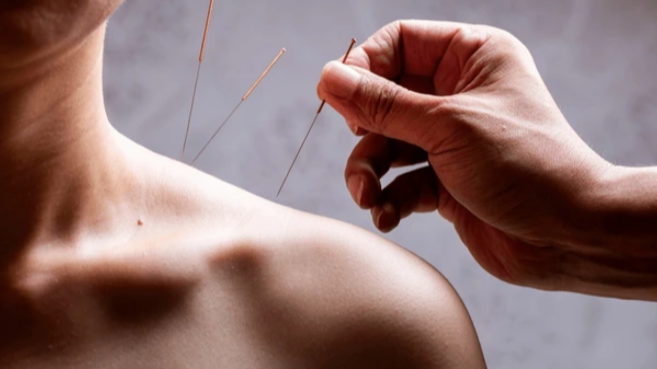 Acupuncture and Chinese Medicine for Teens