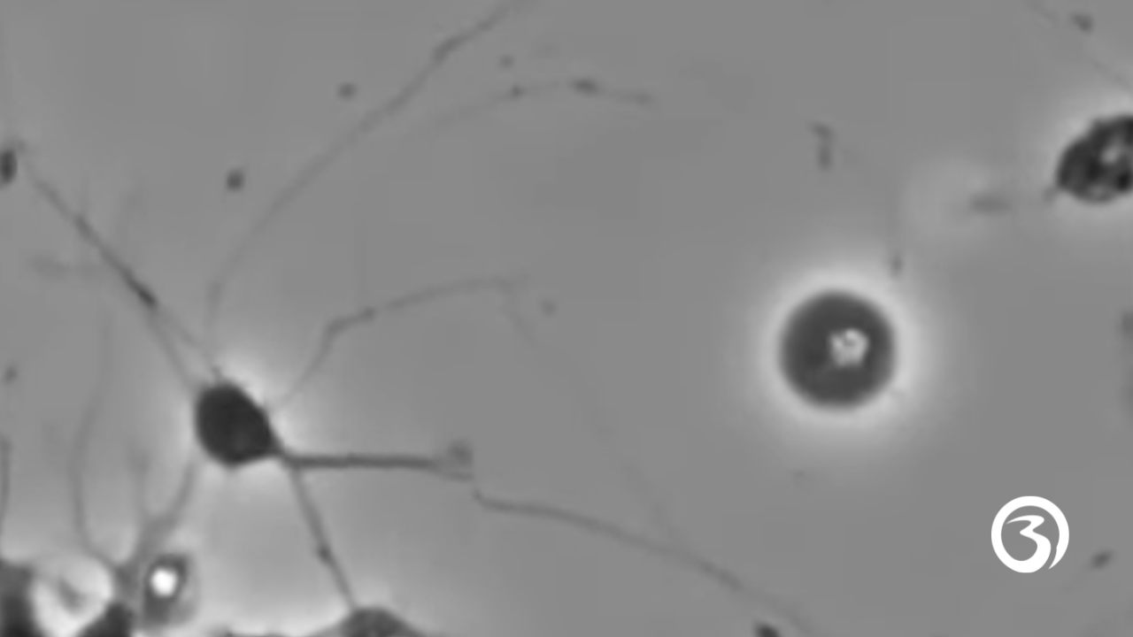 How learning looks in our brains (Source: Caroline Leaf)