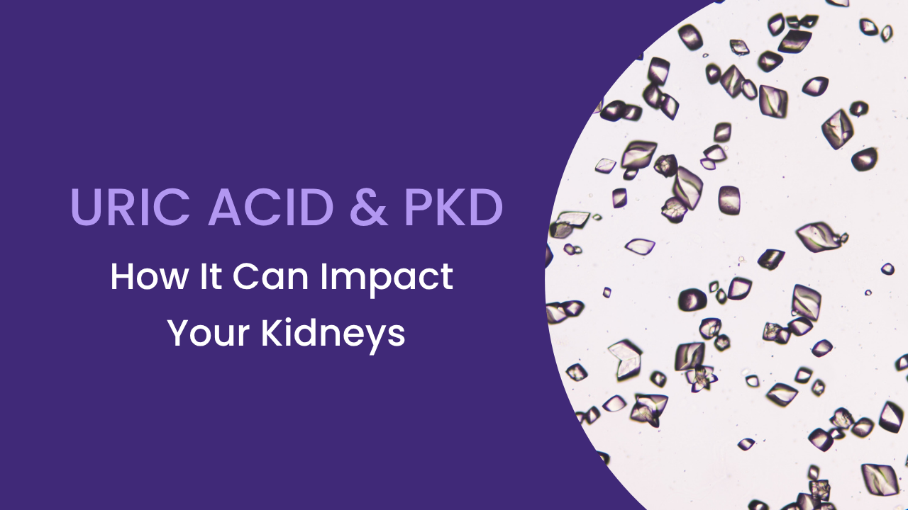 uric acid crystals, pkd, ADPKD, kidney health, progression