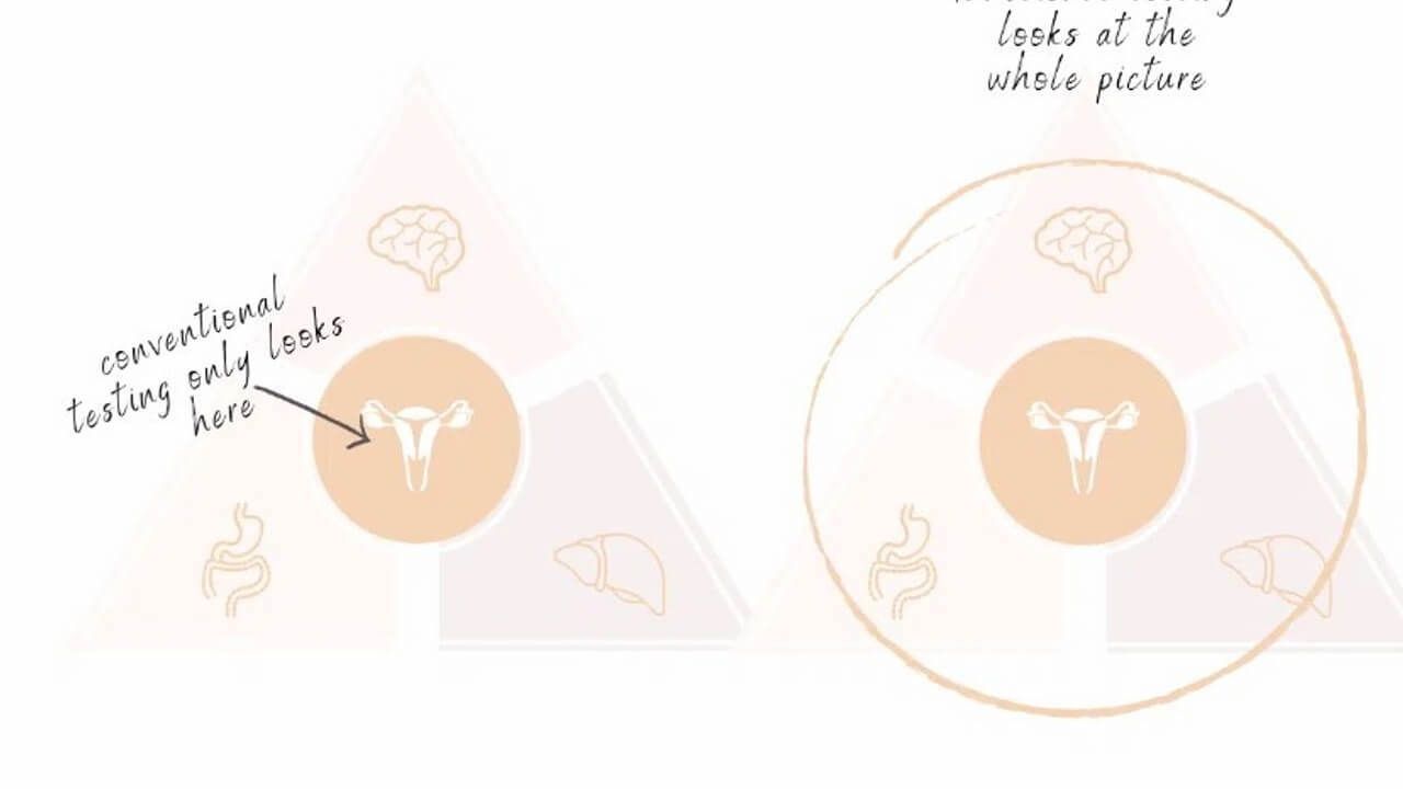 A graphic helps make unexplained infertility explained