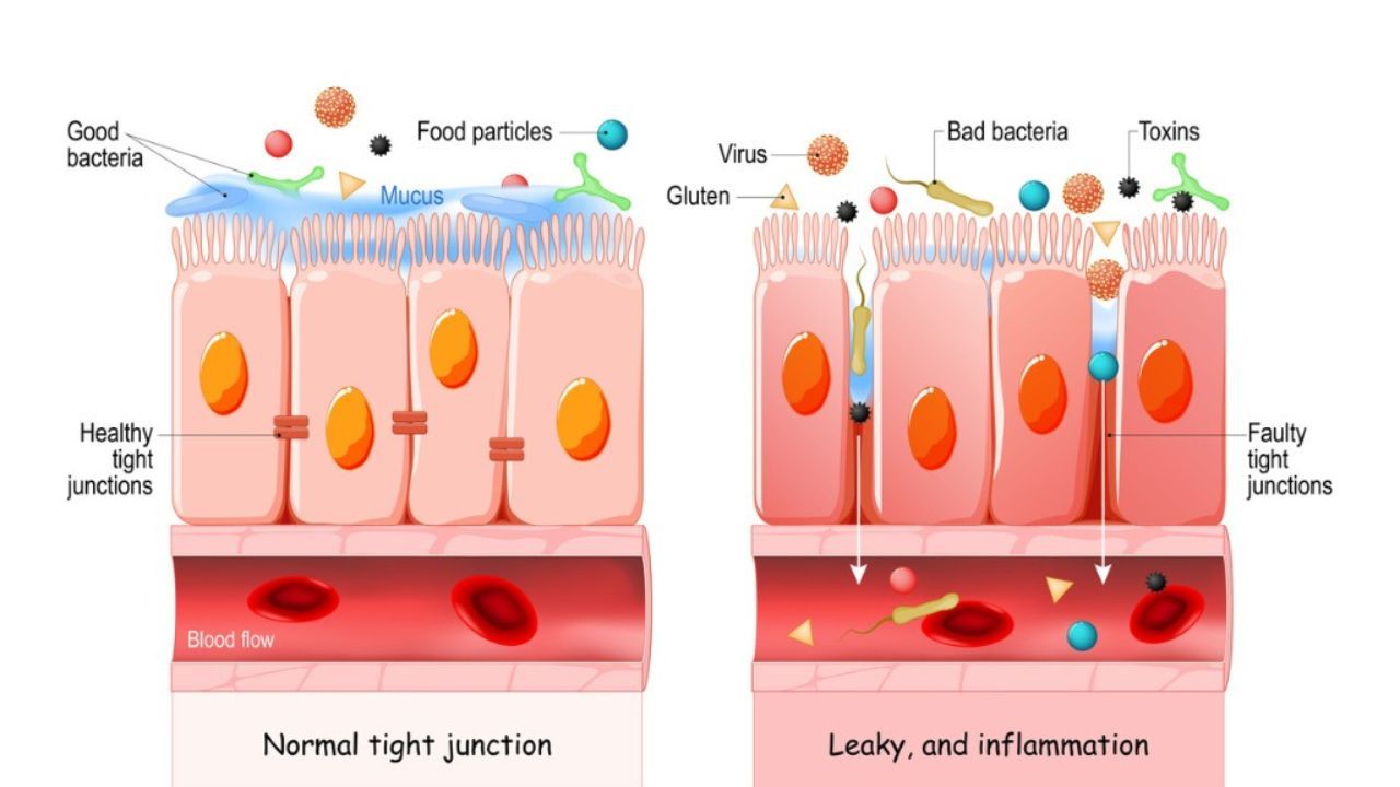 slice of intestines demonstrating how leaky gut occurs