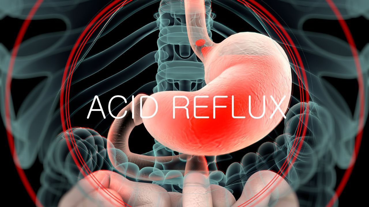 burning stomach resembling acid reflux