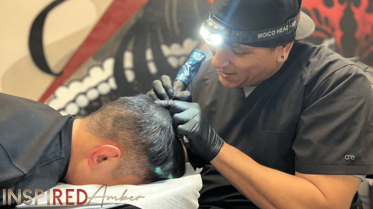 Before and after comparison of scalp micropigmentation vs hair transplant results