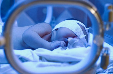 Neugeborenes bei einer Phototherapie gegen Gelbsucht