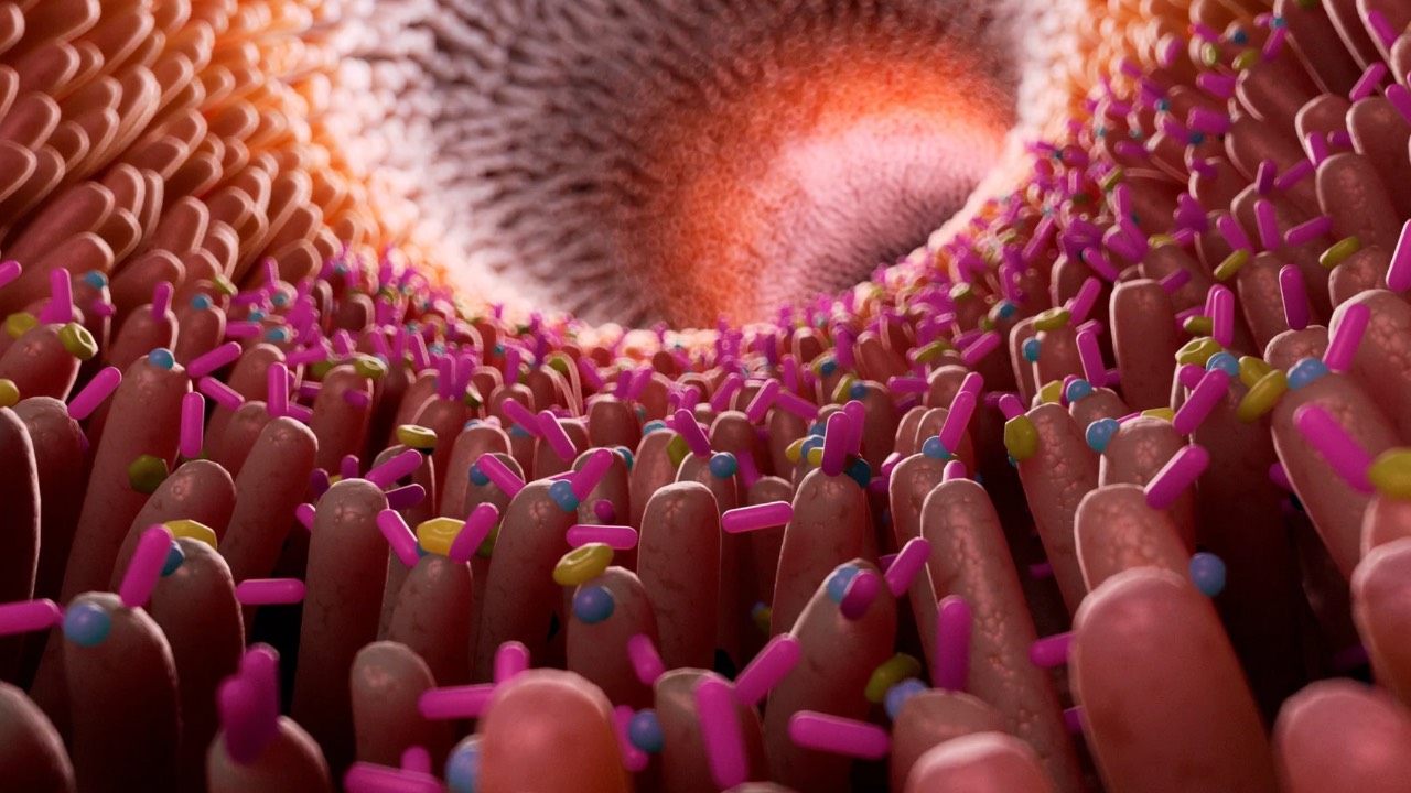 ¿Qué es la hipersensibilidad visceral?