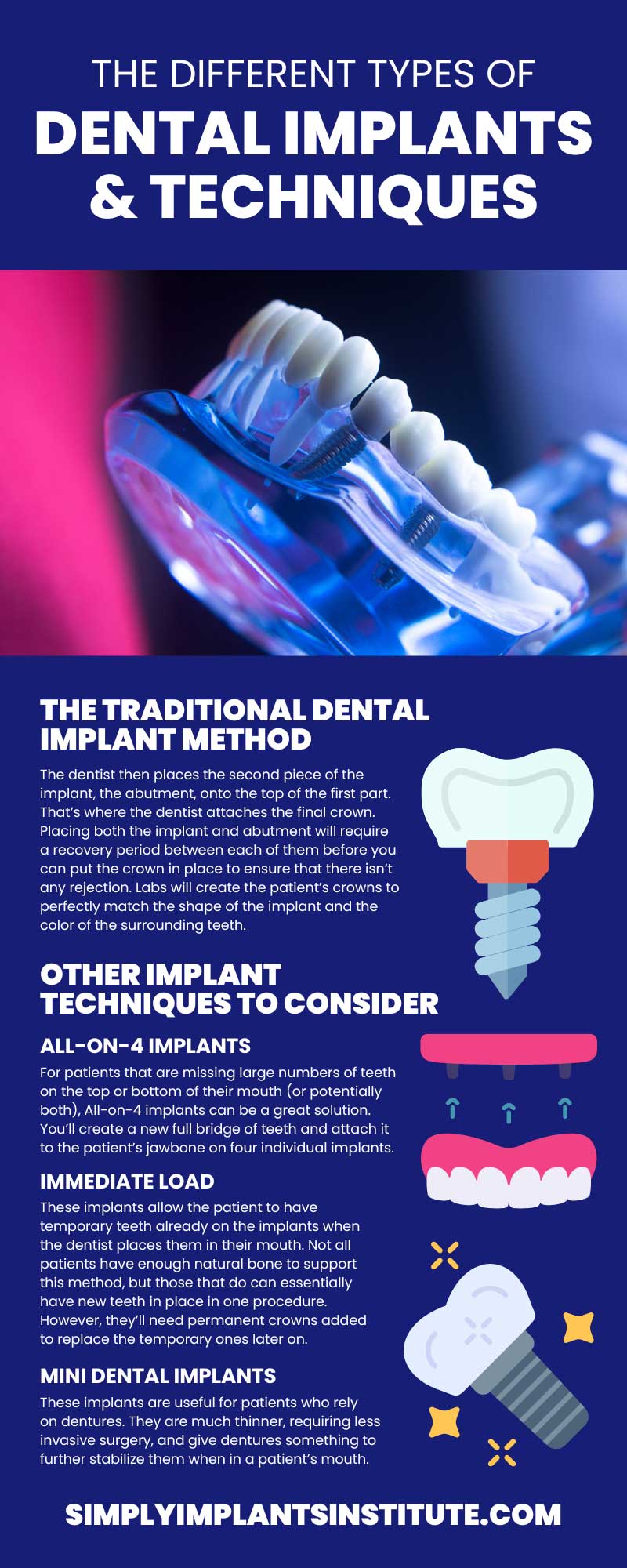 The Different Types of Dental Implants & Techniques