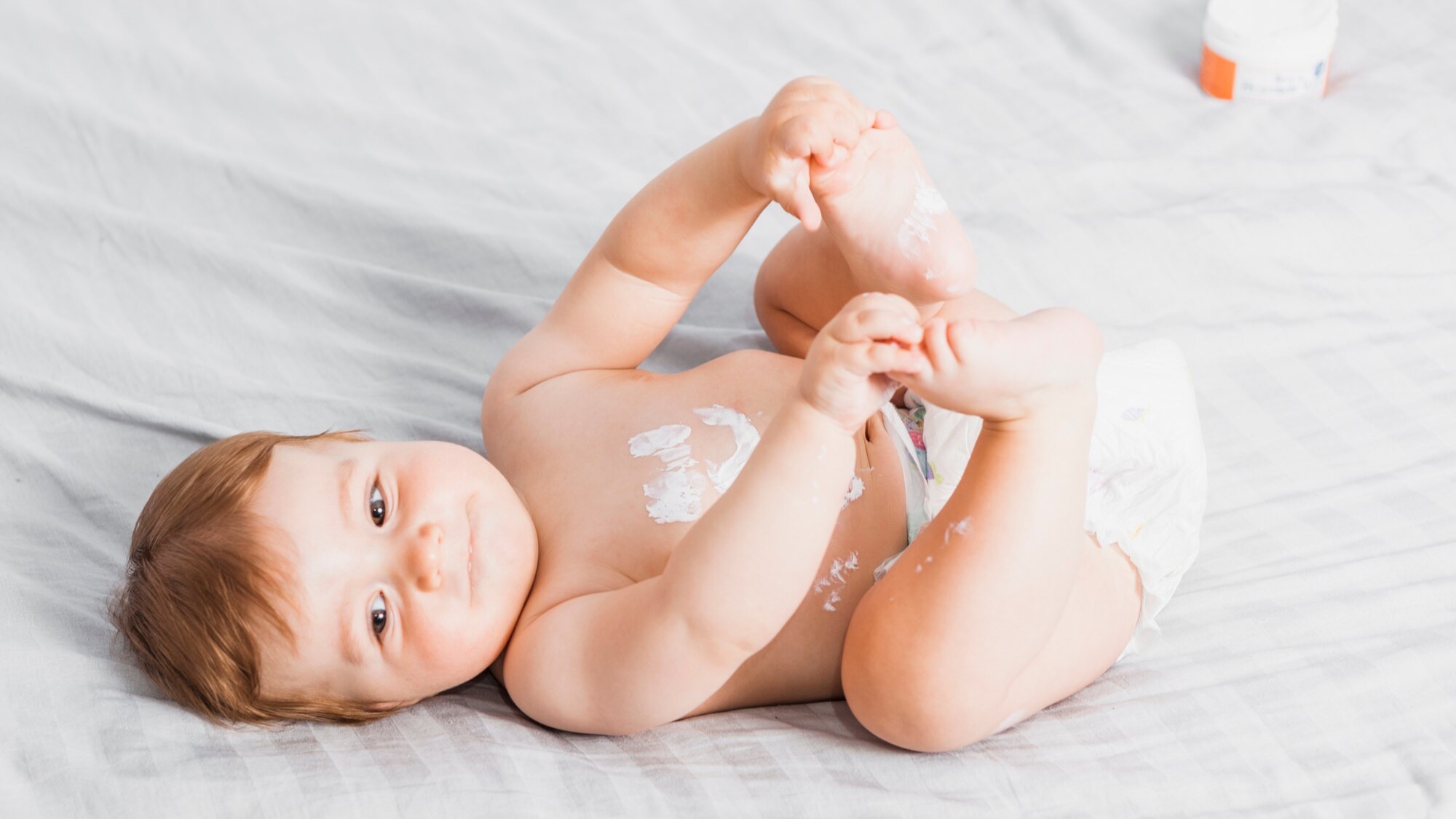 baby-with-diaper-rash-during-diaper-change