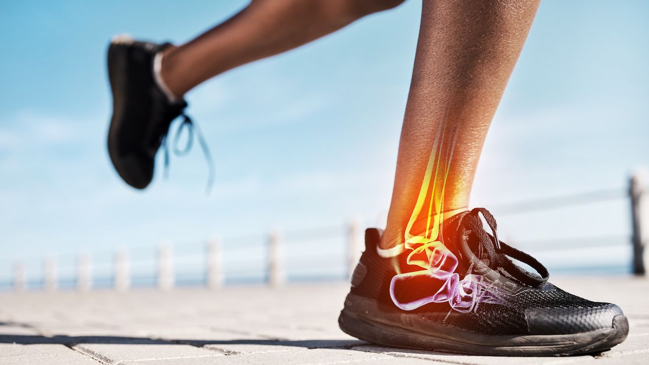 Runner ankle pain