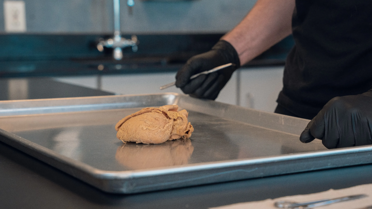 Human heart anatomy specimen on a dissection tray in the Institute of Human Anatomy lab, with gloved hands and surgical tools demonstrating heart structure for heart failure causes, symptoms, diagnosis, and treatment.