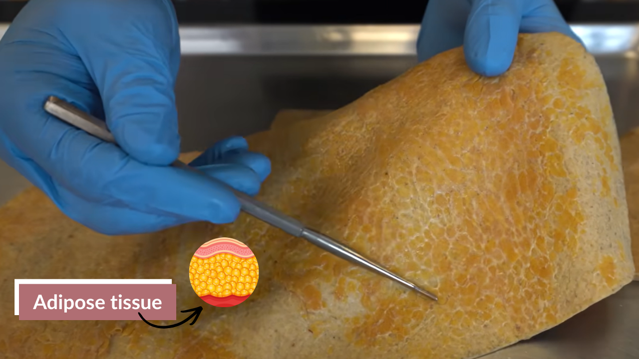Close-up of human cadaver skin showing the hypodermis (subcutaneous adipose tissue) layer. Blue-gloved hands use a dissection tool to highlight this layer. Inset magnified diagram illustrates adipose tissue structure, demonstrating how tattoo ink interacts with deeper skin layers.