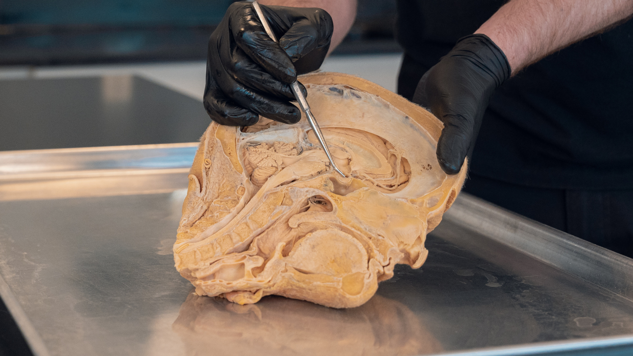 Medical instructor pointing at internal brain structures on a cross-section sagittal view of a human head cadaver specimen during an anatomy lab.