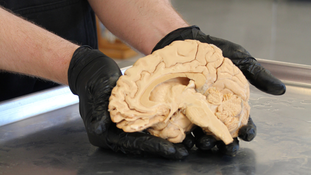 Medial sagittal view of a human brain hemisphere being held by a medical researcher during a neuroanatomy cadaver lab study.