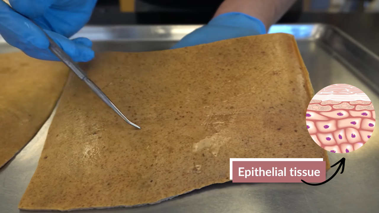 Close-up of human skin showing the epidermis, with a gloved hand using a dissection tool, alongside an inset diagram illustrating the layers of epithelial tissue, highlighting skin anatomy and mucosal surfaces.
