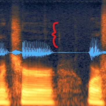 An audio recording waveform displayed in an audio editor
