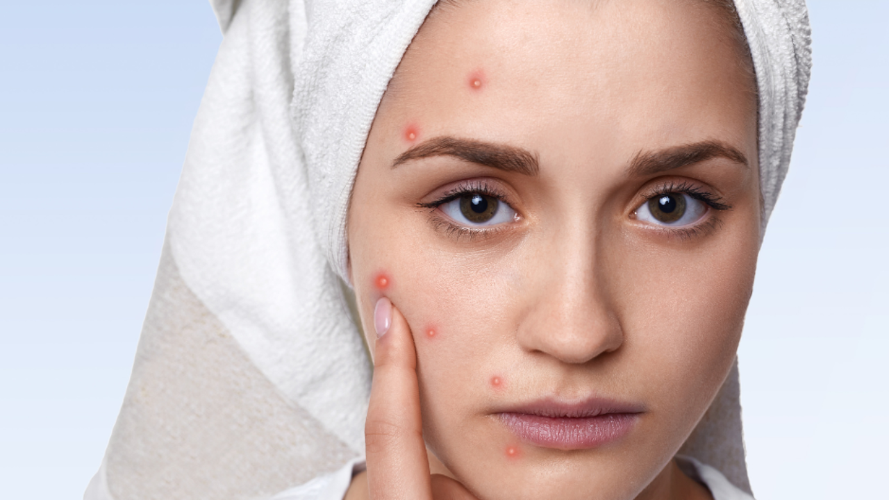 How Healing Your Gut Can Clear Your Skin