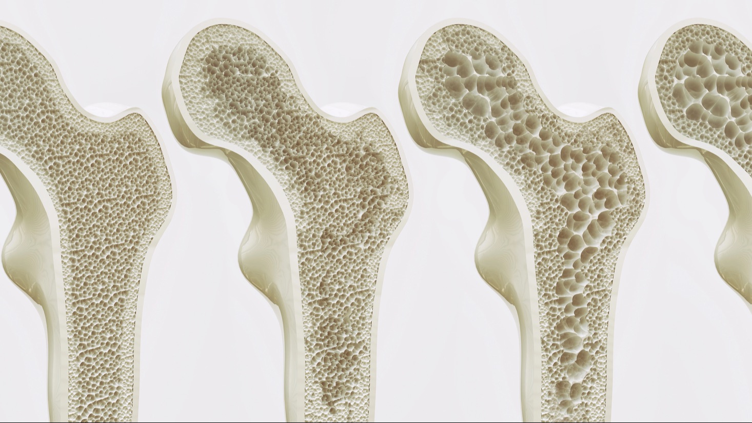 La santé de vos os pendant la périménopause - Dre Laurence Froidevaux sur plantastique.com