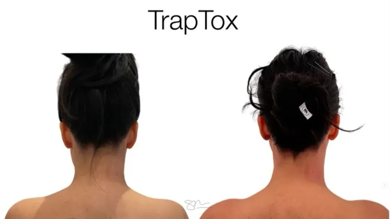 traptox