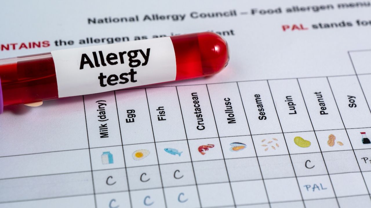 intolleranze e allergie alimentari