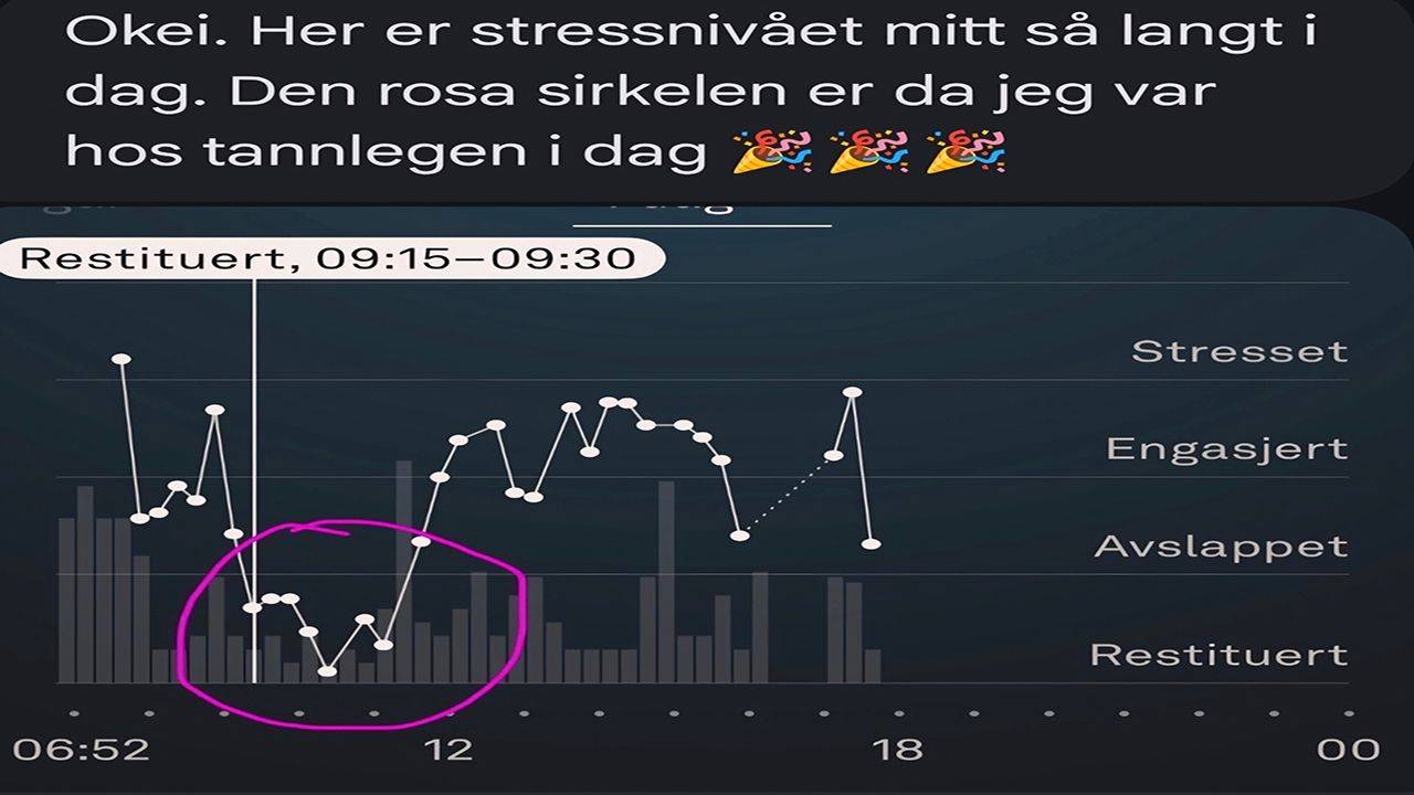En kunde gikk fra tannlegeskrekk til full ro – og klokken målte restitusjon under tannbehandling – etter én hypnosesesjon. Se historien og forskningen bak.
