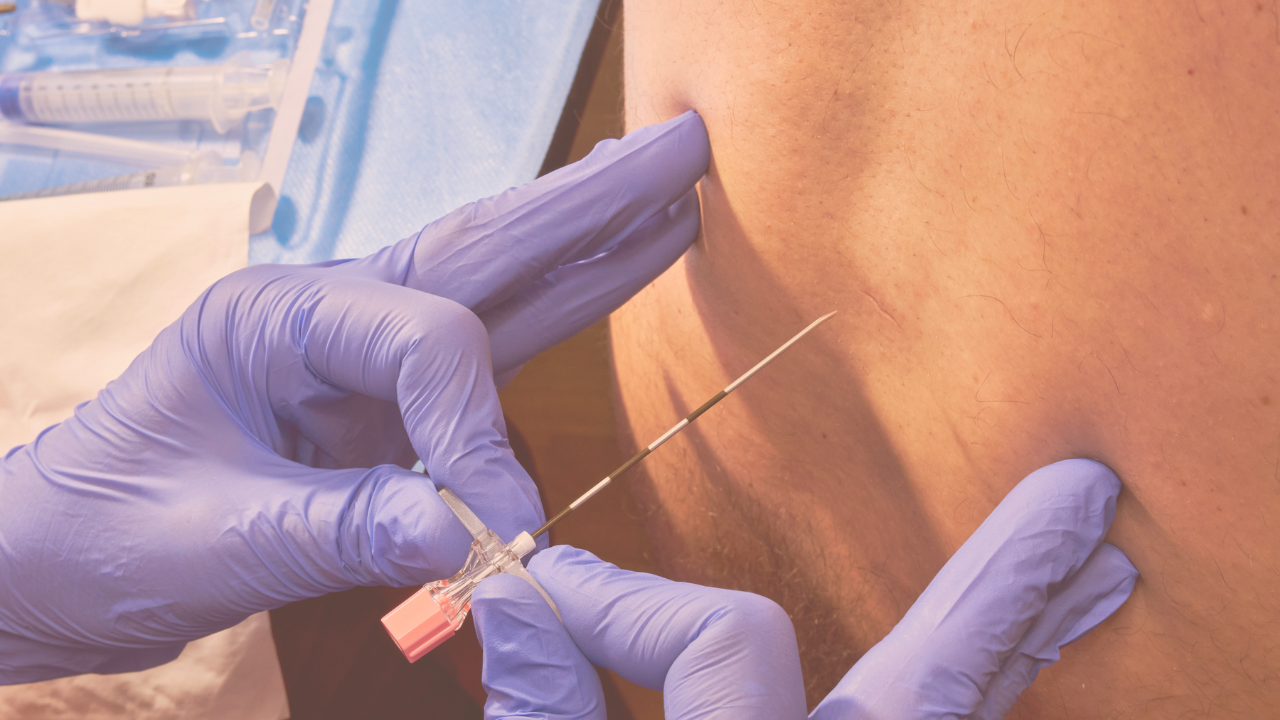 a doctor administering an epidural