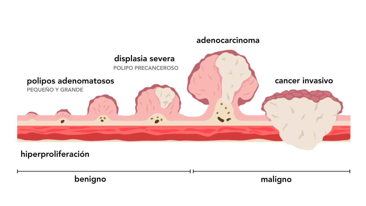 Illustration by Yaja’ Mulcare