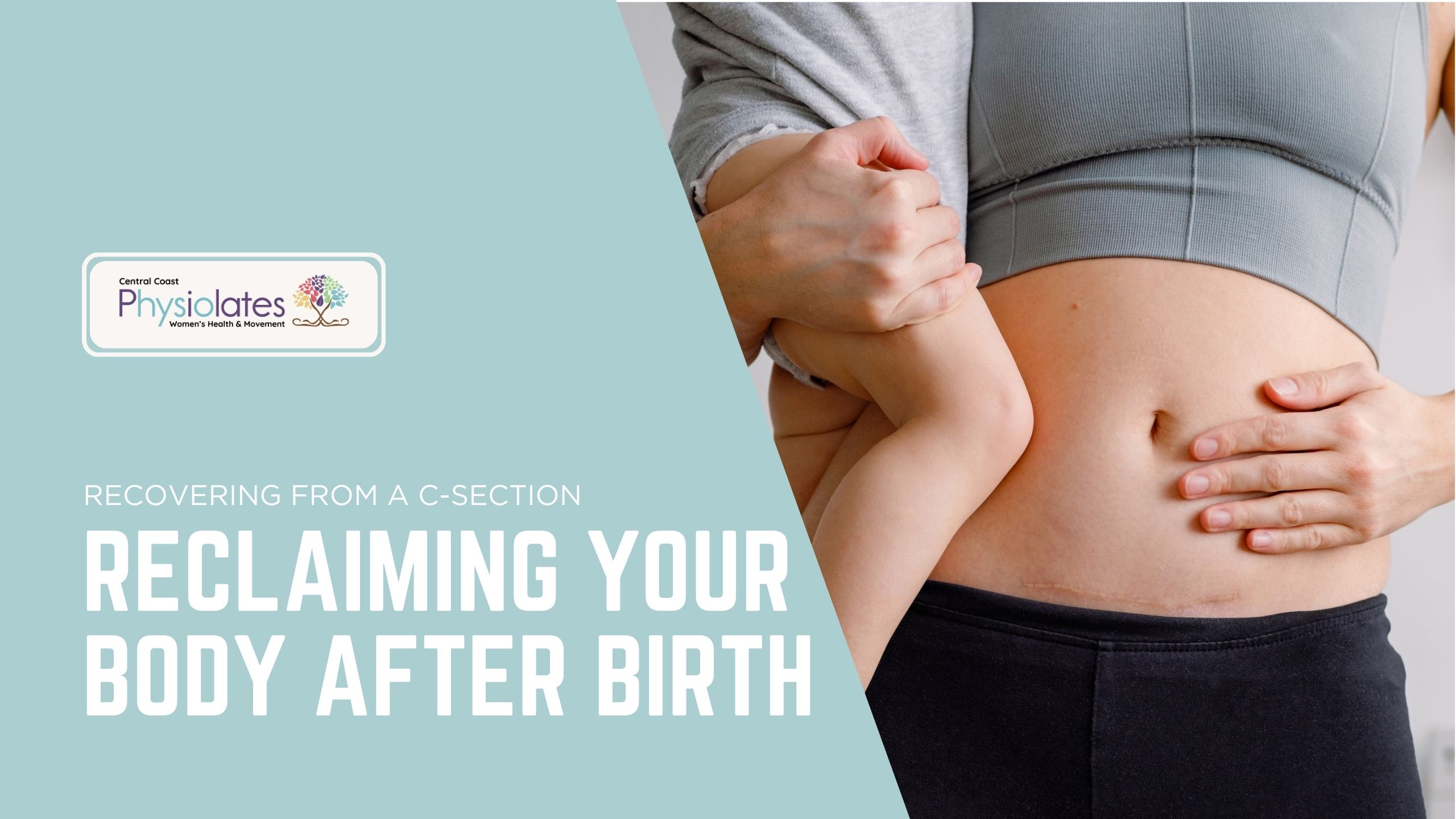 The Emotional & Physical Reality of C-Section Recovery: Reclaiming Your Body After Birth