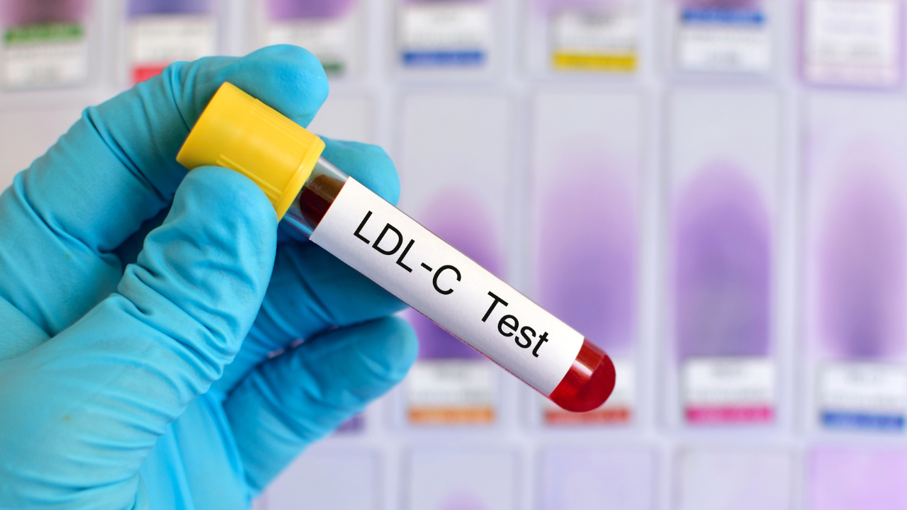 blue-gloved hand holding a vial with the label reading "LDL-C Test"