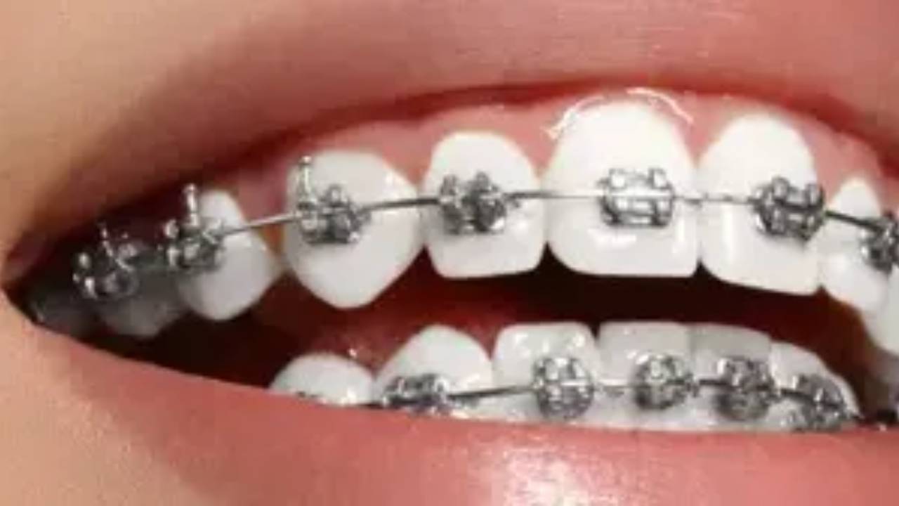 Best Tips for Ortho in Dentrix