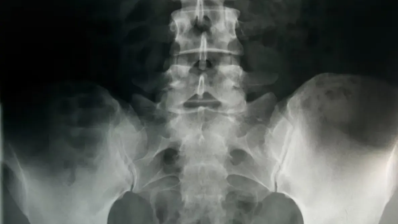 X-ray of spine