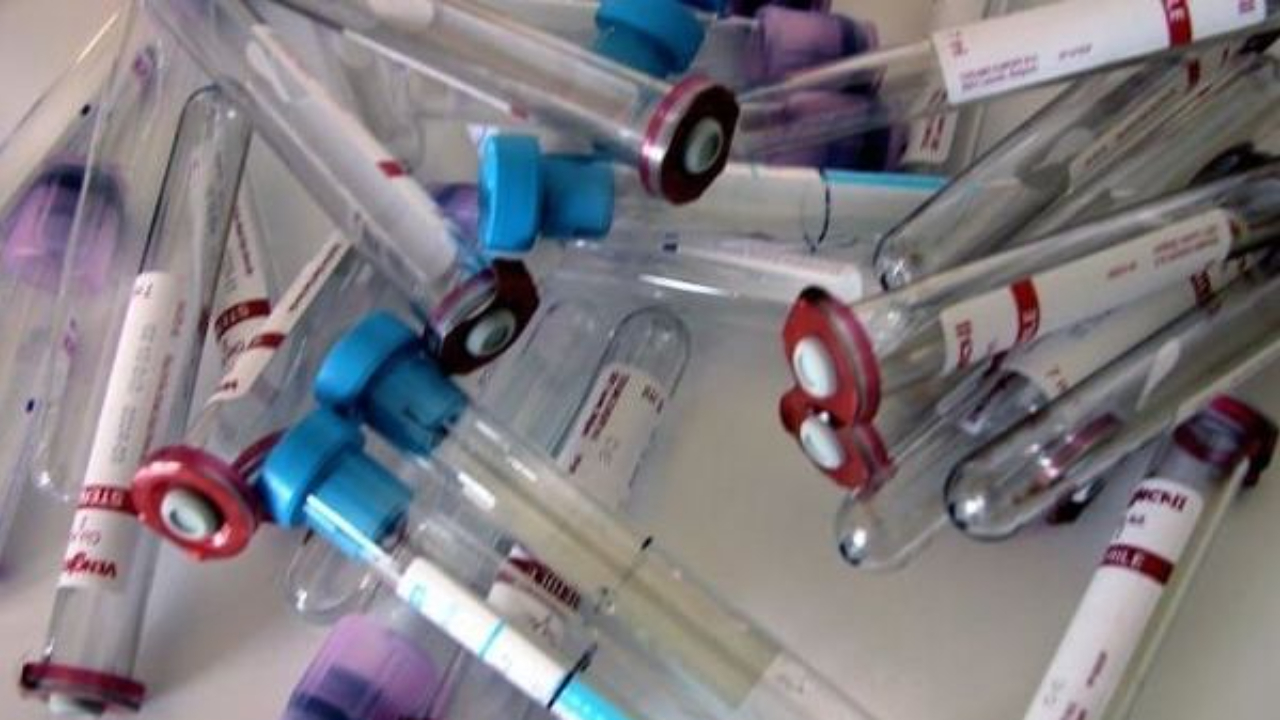 Intolleranze alimentari e aumento di peso: esiste un rapporto di causa-effetto?