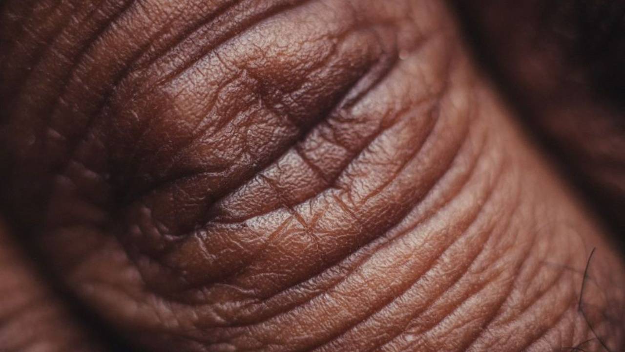 pelle che invecchia ed evidenzia il processo di invecchiamento cellulare