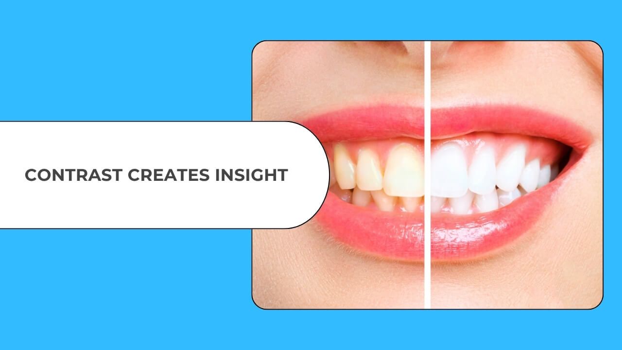 Close-up of a smile showing before-and-after teeth whitening, illustrating the power of contrast for insight and clarity.