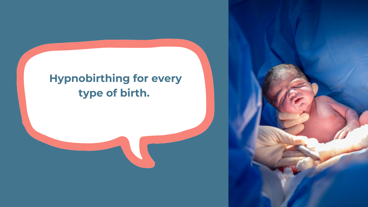 Hypnobirthing for every type of birth